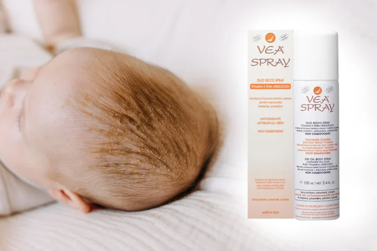 Foto di prodotto della recensione e inci vea olio spray e bambino con crosta lattea